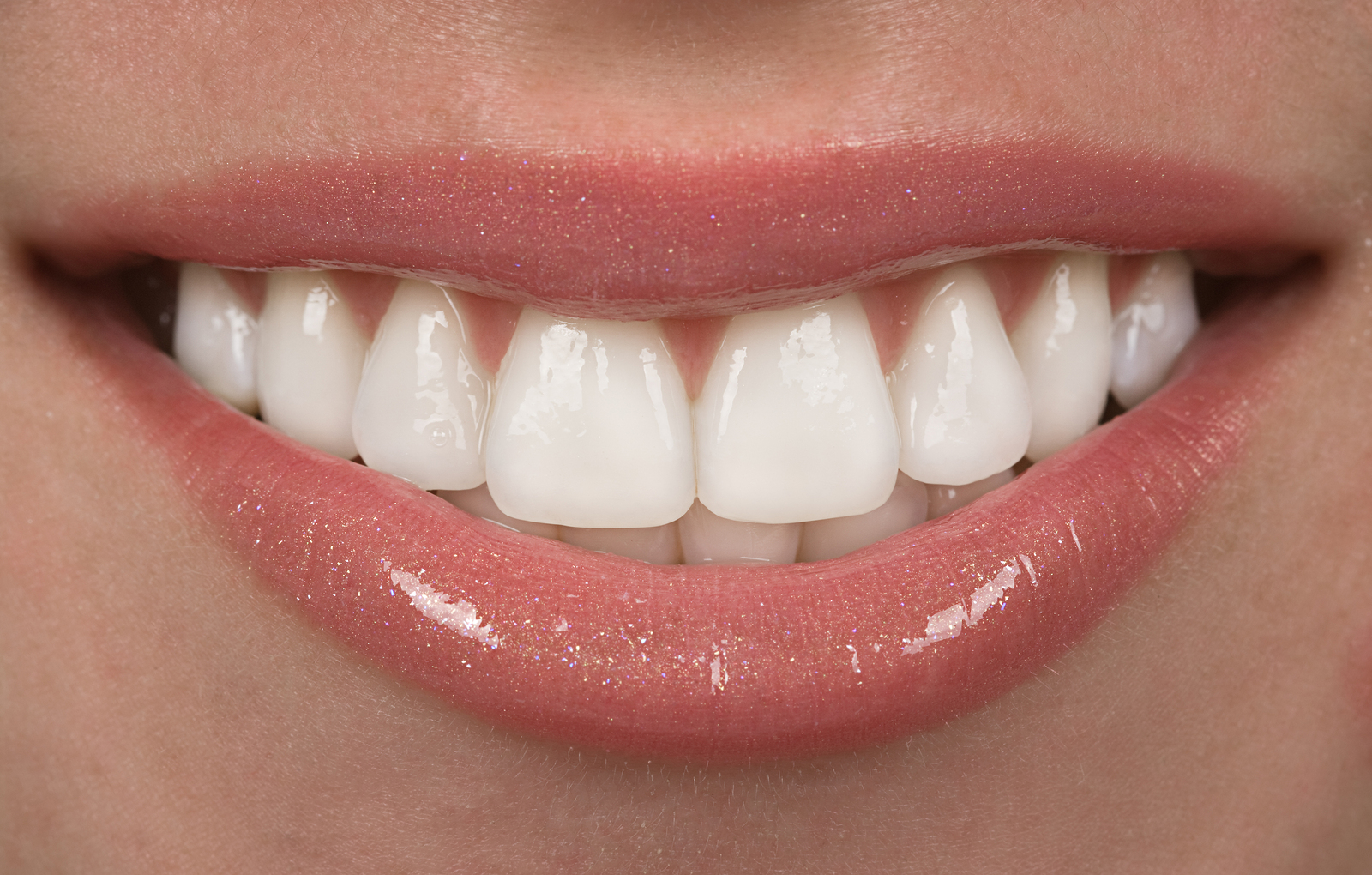 porcelain dental veneers